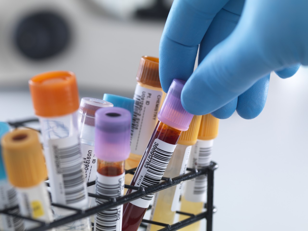 一致性评价大幕开启，，，医院市场即将调解