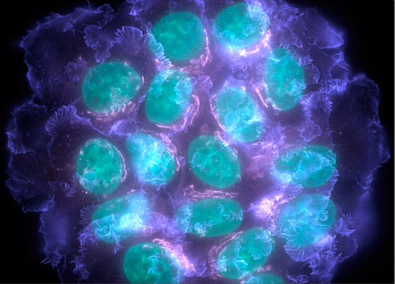 豪门国际官网-追求康健,你我一起开展