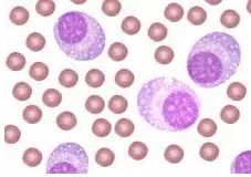 豪门国际官网-追求康健,你我一起开展