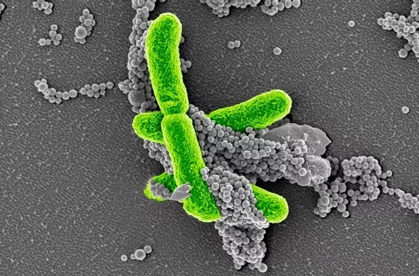 豪门国际官网-追求康健,你我一起开展