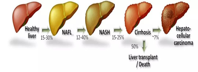 肝癌形成历程
