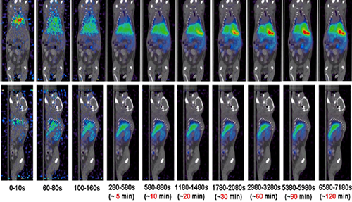 豪门国际官网PET/CT分子影像手艺平台