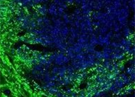 联协实力！！溶瘤病毒与CAR-T翻开攻克实体瘤难题的新思绪