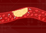 【Science速递】攻克COVID-19里程碑：：：已确定血凝块形成原因！