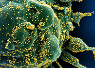 唾液检测新冠抗体新要领来了，，，获取效果仅需几小时！