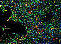 天下首创：：：药物将干细胞指导至受损部位，，提高其愈合能力！！！