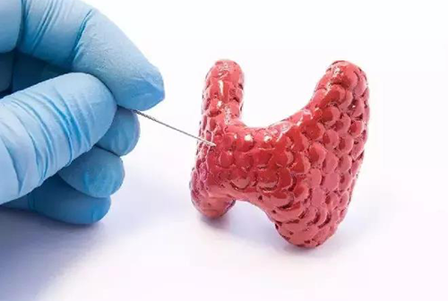 甲状腺疾。。鬃聪俟πЪ跬撕图鬃聪俟πЭ航怨乓岳淳褪侵馗幢灰窖а芯恐霸毖芯康募膊