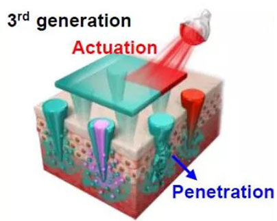 第三代：通过微针介导的皮肤层破损和微针陪同的种种功效增强药物转运.jpg