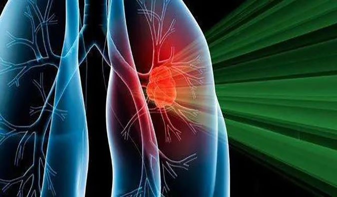 盛世泰科1类立异药物CGT-9475实现中美双报双批 | 豪门国际官网一站式临床宿世物医药研发服务平台助力