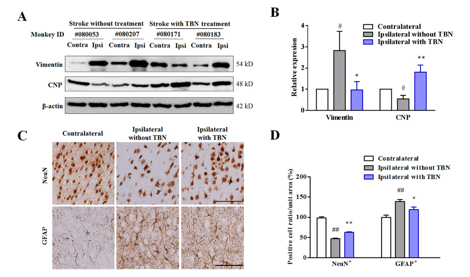 TBN是一种治疗缺血性卒中的新型临床候选药物，，，本研究中TBN通过豪门国际官网合成